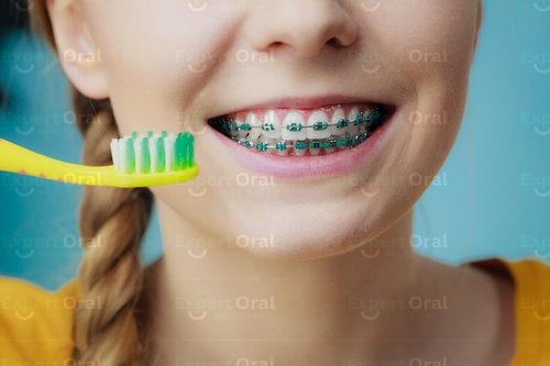 To Brush or Not to Brush: Navigating the First Day of Braces